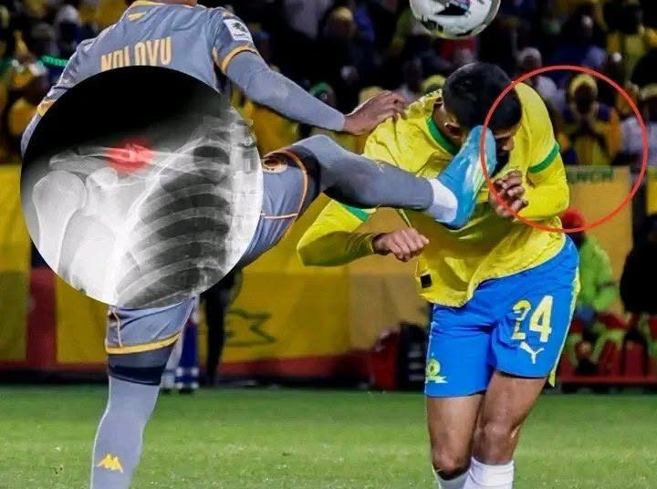 No card was given, no apology was issued, the player is still out injured.